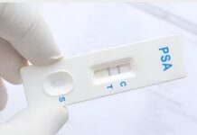 Noviembre, Mes Azul: refuerzan llamado a exámenes prostáticos en Toluca Prueba-cáncer-próstata