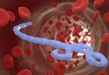 Alerta mundial por brote de ébola: OMS advierte rápida propagación; México refuerza vigilancia sanitaria Ebolavirus