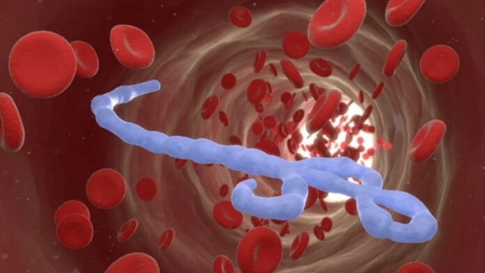 Ebolavirus Ebolavirus