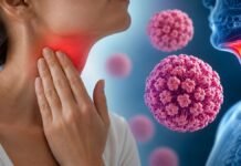 Virus del Papiloma Humano ya está relacionado con más casos de cáncer de garganta que el cigarro Virus del Papiloma Humano ya está relacionado con más casos de cáncer de garganta que el cigarro