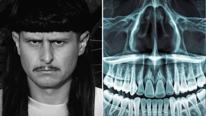 Identificación de Oliver Tree mediante registros dentales